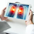 Subcategoría Infecciones respiratorias